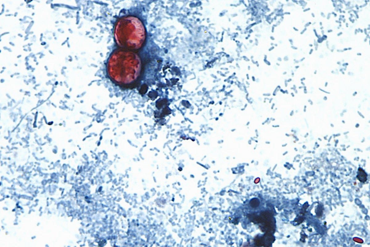 Cyclospora outbreak reaches UK as holidaymakers warned over parasite linked to Mexico
